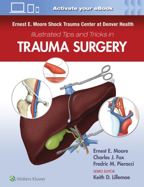 Bilde av Ernest E. Moore Shock Trauma Center At Denver Health Illustrated Tips And Tricks In Trauma Surgery