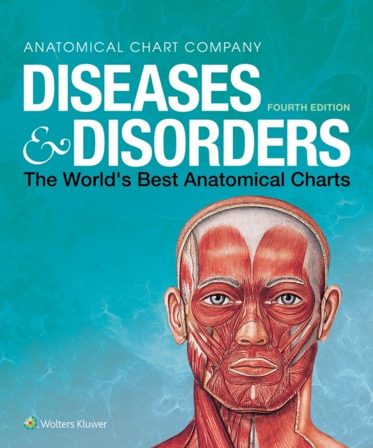 Bilde av Diseases &amp; Disorders Av Anatomical Chart Company