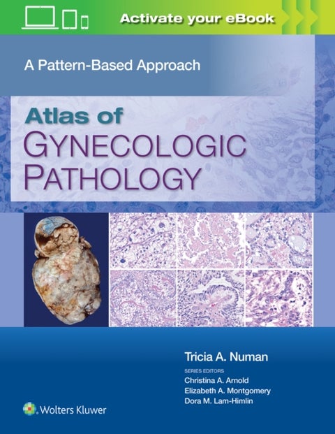 Atlas of Gynecologic Pathology - A Pattern-Based Approach: Print + eBook with Multimedia