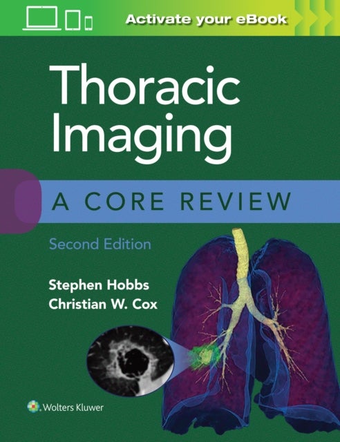 Bilde av Thoracic Imaging: A Core Review Av Stephen Hobbs, Christian Cox