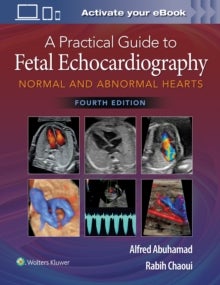 A Practical Guide to Fetal Echocardiography - Normal and Abnormal Hearts