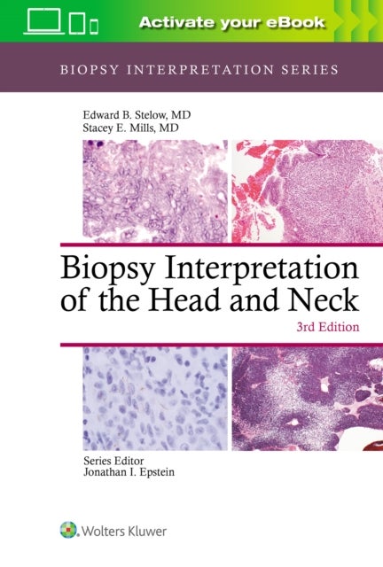 Bilde av Biopsy Interpretation Of The Head And Neck Av Edward B. Stelow, Stacey Mills