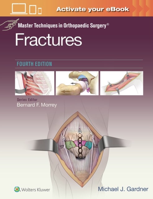 Bilde av Master Techniques In Orthopaedic Surgery: Fractures Av Michael J. Gardner
