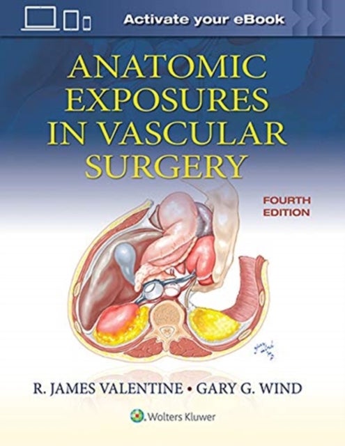 Bilde av Anatomic Exposures In Vascular Surgery Av R. James Valentine, Gary G. Wind