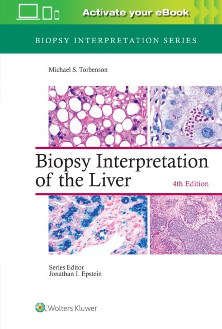 Bilde av Biopsy Interpretation Of The Liver Av Michael Md Torbenson
