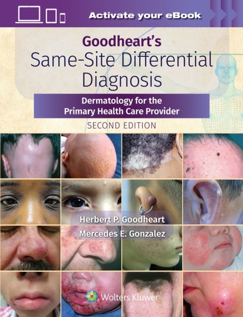 Goodheart's Same-Site Differential Diagnosis - Dermatology for the Primary Health Care Provider