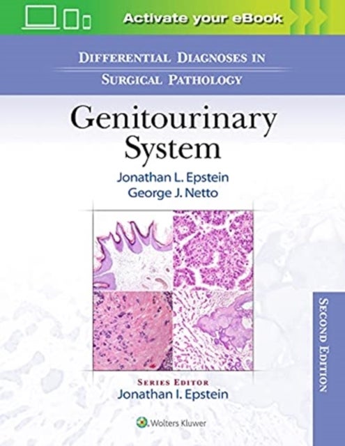 Bilde av Differential Diagnoses In Surgical Pathology: Genitourinary System Av Jonathan Epstein, George J. Netto