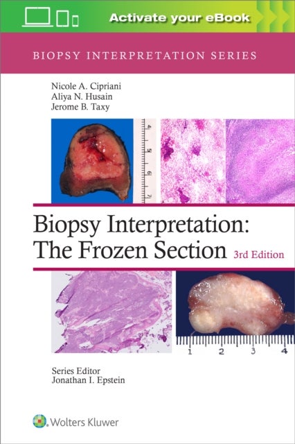 Bilde av Biopsy Interpretation: The Frozen Section Av Nicole A. Md Cipriani, Aliya N. Husain, Jerome B. Taxy