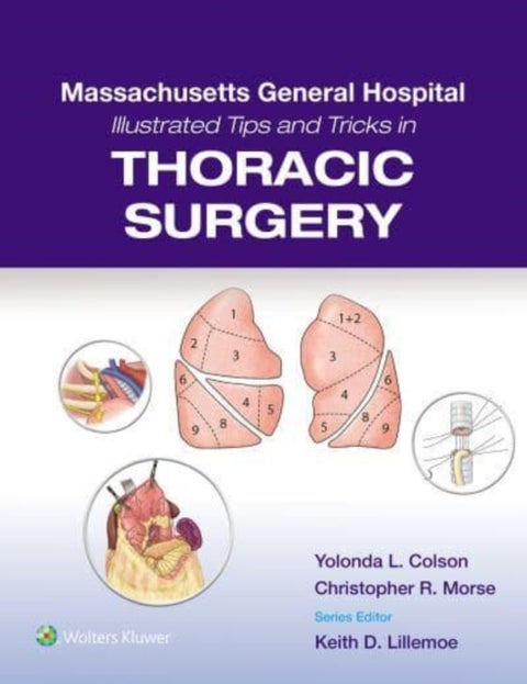 Massachusetts General Hospital Illustrated Tips and Tricks in Thoracic Surgery: Print + eBook with M