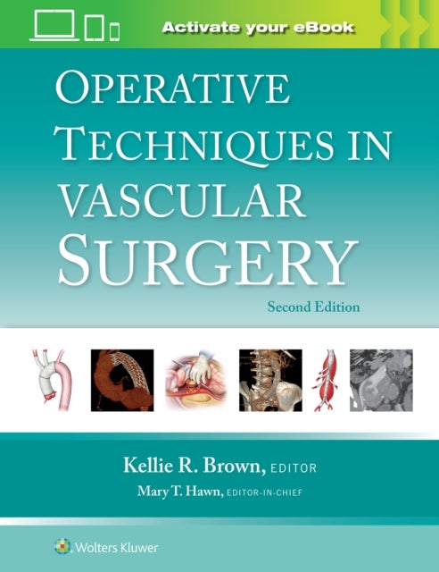 Bilde av Operative Techniques In Vascular Surgery