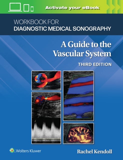 Bilde av Workbook For Diagnostic Medical Sonography: The Vascular Systems Av Ann Marie Phd Rvt Kupinski