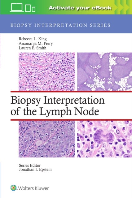 Bilde av Biopsy Interpretation Of The Lymph Node Av Rebecca Leigh Md King, Anamarija M. Md Perry, Lauren B. Smith