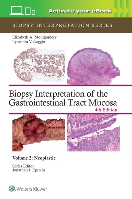 Biopsy Interpretation of the Gastrointestinal Tract Mucosa Volume 2 - Neoplastic: Print + eBook with Multimedia