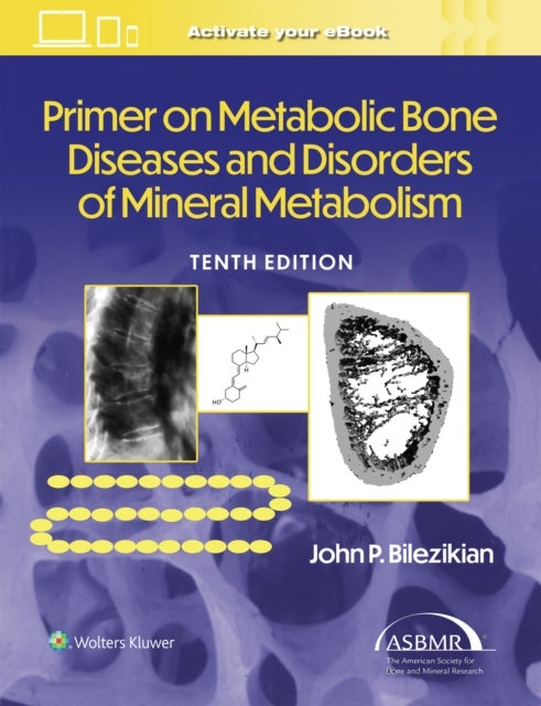 Primer on the Metabolic Bone Diseases and Disorder