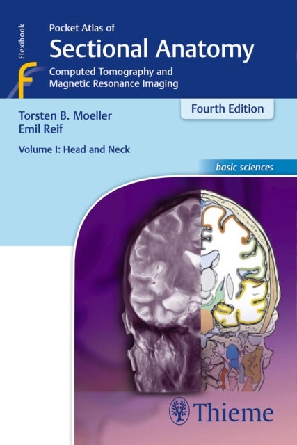 Pocket Atlas of Sectional Anatomy, Volume I: Head and Neck - Computed Tomography and Magnetic Resonance Imaging