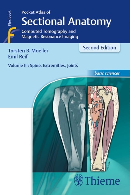 Bilde av Pocket Atlas Of Sectional Anatomy, Volume Iii: Spine, Extremities, Joints Av Torsten Bert Moeller, Emil Reif
