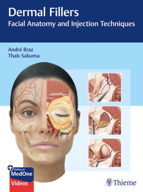 Dermal Fillers - Facial Anatomy and Injection Techniques