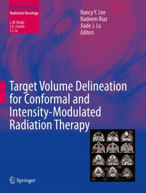 Bilde av Target Volume Delineation For Conformal And Intensity-modulated Radiation Therapy