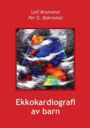 Ekkokardiografi av barn