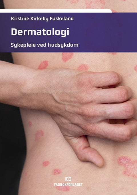 Dermatologi - sykepleie ved hudsykdom