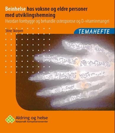 Beinhelse hos voksne og eldre personer med utviklingshemning - hvordan forebygge og behandle osteoporose og D-vitaminmangel