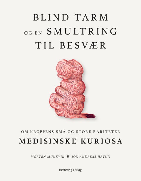 Blind tarm og en smultring til besvær - om kroppens små og store rariteter : medisinske kuriosa