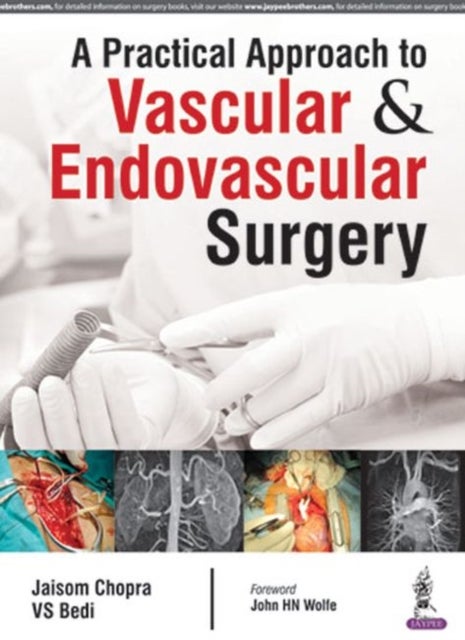 Bilde av A Practical Approach To Vascular &amp; Endovascular Surgery Av Jaisom Chopra, Varinder Singh Bedi