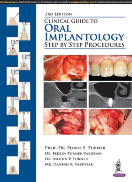 Bilde av Clinical Guide To Oral Implantology Av Porus S Turner, Ferzin Turner Vazifdar, Ashdin P Turner, Danesh R Vazifdar