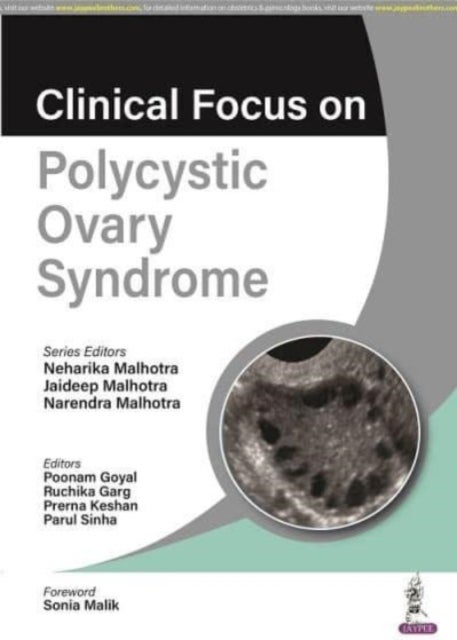 Bilde av Clinical Focus On Polycystic Ovary Syndrome Av Neharika Malhotra, Jaideep Malhotra, Narendra Malhotra