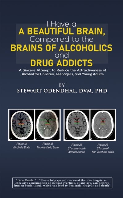 I Have a Beautiful Brain, Compared to the Brains of Alcoholics and Drug Addicts - A Sincere Attempt to Reduce the Attractiveness of Alcohol for Children, Teenagers, and Young Adults